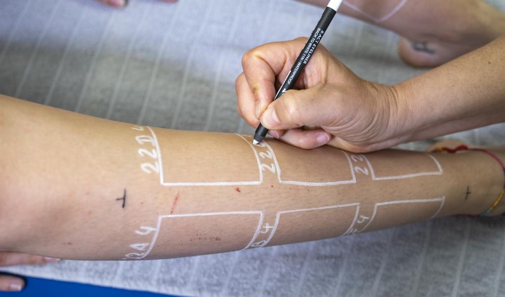 Laboratoriet merker de seks behandlingsflatene på hvert ben. Foto: Tobias Meyer