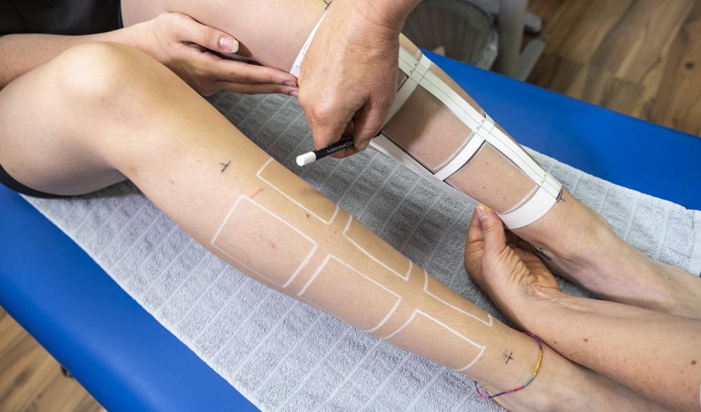 Laboratoriet mäter ut placering av de sex behandlingsytorna på varje ben. Foto: Tobias Meyer